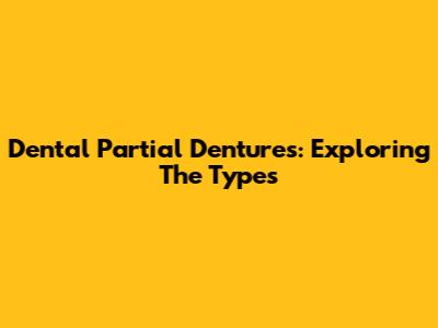 Dental Partial Dentures: Exploring The Types