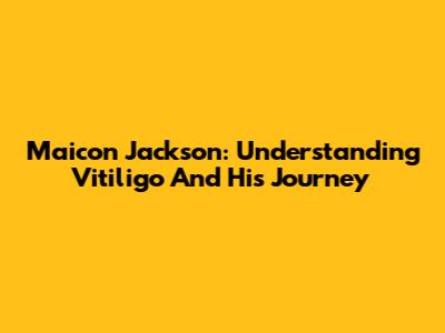 Maicon Jackson: Understanding Vitiligo And His Journey